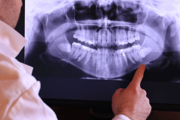 Best Emergency Gum Pain Relief  in Curwensville, PA